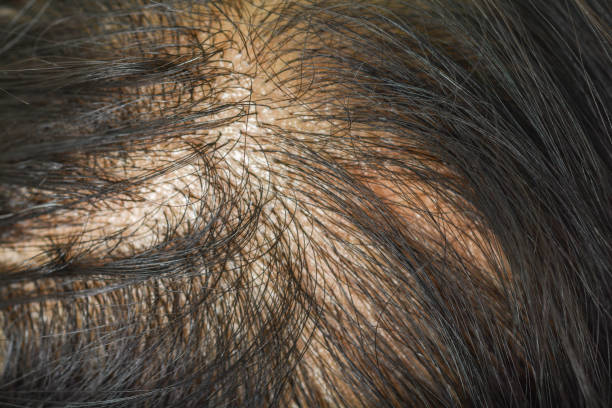 istock thin hair in women 859590834