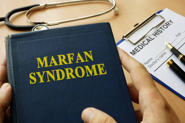 istock Book with title Marfan Syndrome on a table. 859610802
