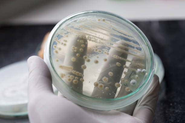 istock Yeast in petri dish, Microbiology for education in laboratories. 859674600