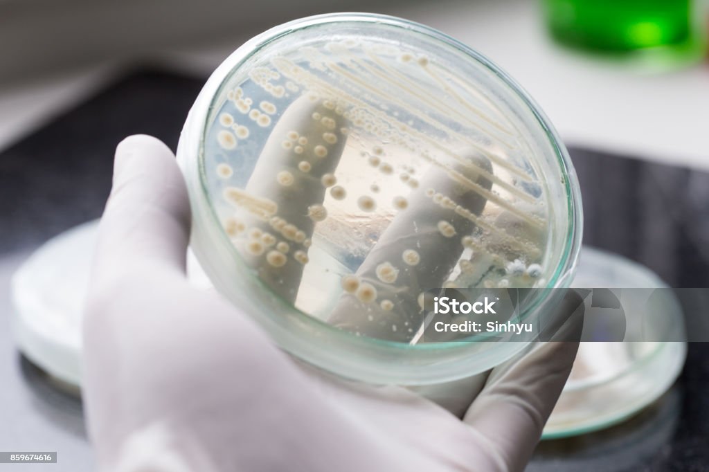 Yeast in petri dish, Microbiology for education in laboratories. Fungus Stock Photo