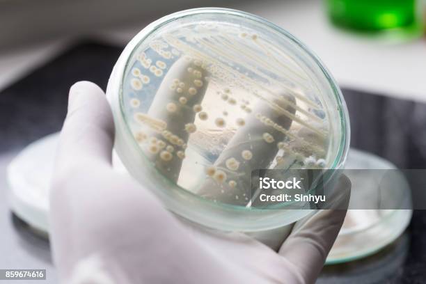 Yeast In Petri Dish Microbiology For Education In Laboratories Stock Photo - Download Image Now