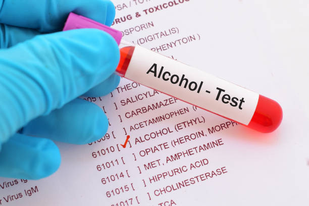 Alcohol test stock photo