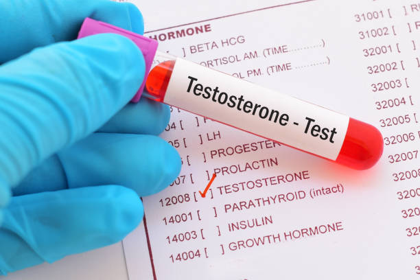 Testosterone Test Sample 250+ Testosterone Blood Test Stock Photos, Pictures & Royalty-Free ...