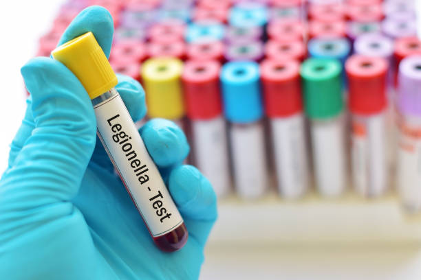 Legionella test stock photo
