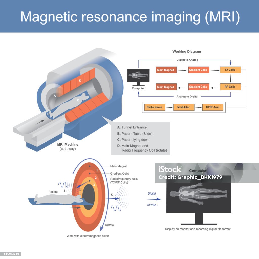 The Mechanical technique used in radio wave to form pictures of the anatomy and the magnetic physiological processes of the body in both health and disease. Illustration graphic. Brain stock vector