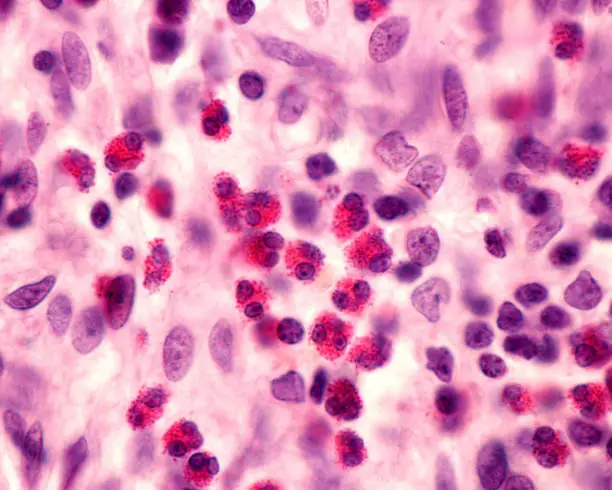 Photo of Eosinophil granulocytes