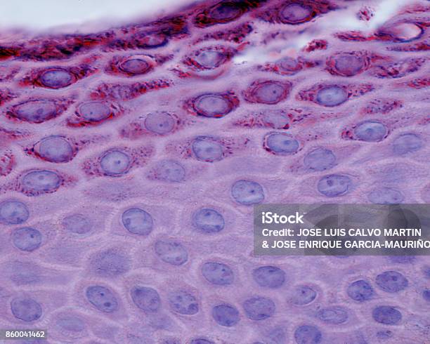 Epidermis Stock Photo - Download Image Now - Biological Cell, Skin, Stratum Spinosum
