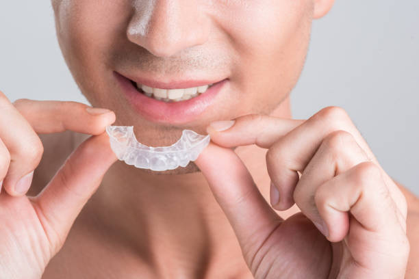 istock Positive guy is demonstrating transparent brace for teeth 860063704