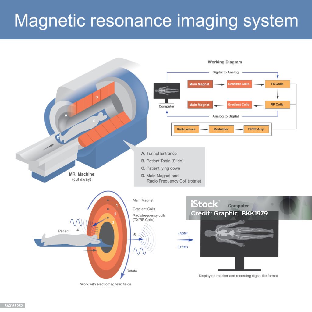 Magnetic resonance imaging system. The Mechanical technique used in radio wave to form pictures of the anatomy and the magnetic physiological processes of the body in both health and disease. Illustration graphic. MRI Scan stock vector