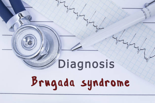 진단 brugada 증후군입니다. 청진 기 또는 ecg 유형의 함께 phonendoscope 제목 진단 brugada 증후군 병력에 거짓말. 심장 내과 대 한 의료 개념 - young at heart audio 뉴스 사진 이미지