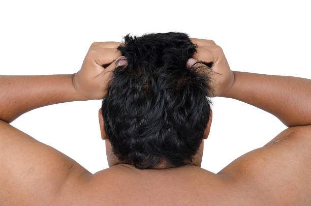 istock Asian man headache face over white background 860439742