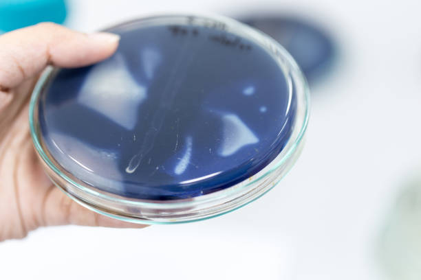 istock Testing infection microbiology with iodine in laboratory. 860513000