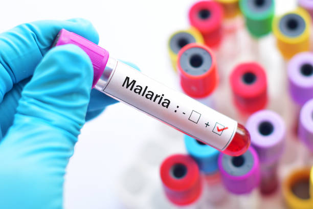 Malaria positive Blood sample with malaria parasite positive malaria blood sample stock pictures, royalty-free photos & images