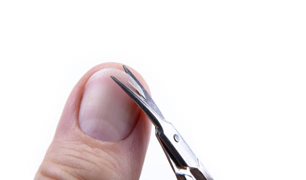 istock Caucasian male hand showing nails on white background 860624724