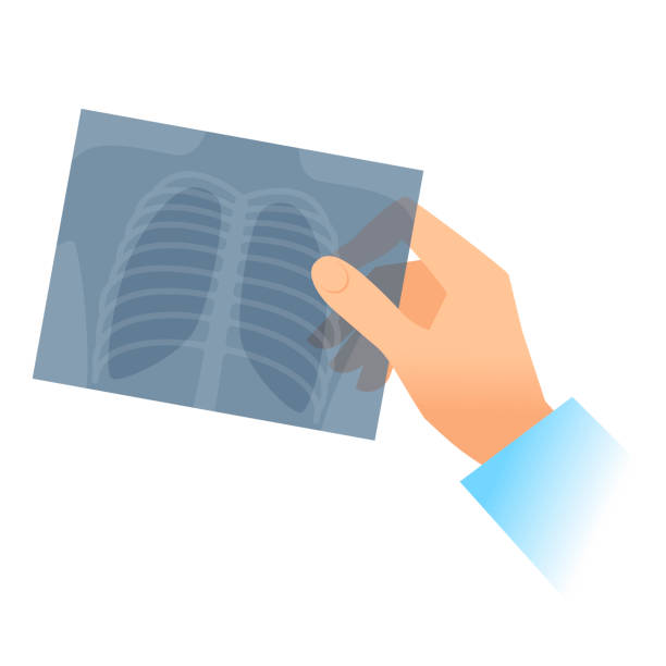 illustrazioni stock, clip art, cartoni animati e icone di tendenza di mano umana con immagine a raggi x del polmone. - human lung x ray image x ray human spine