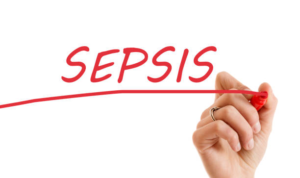 Sepsis Sepsis bacterial mat photos stock pictures, royalty-free photos & images