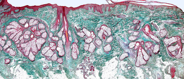 piel vellosa. glándulas sebáceas - human tissue histology dermatology human skin fotografías e imágenes de stock