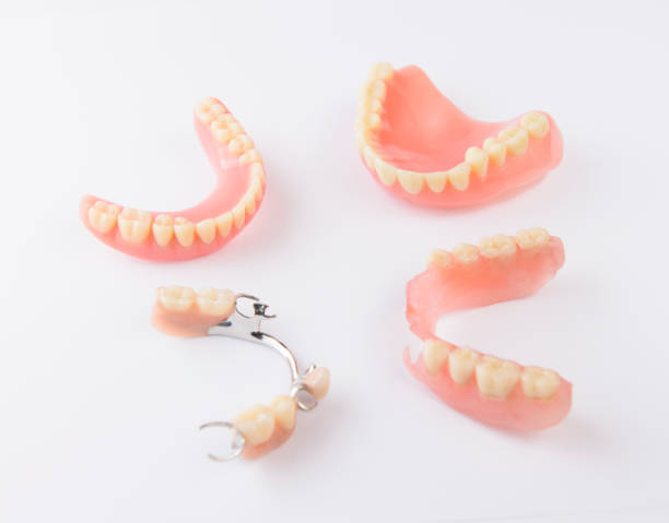 group of dentures on white background - dentures imagens e fotografias de stock