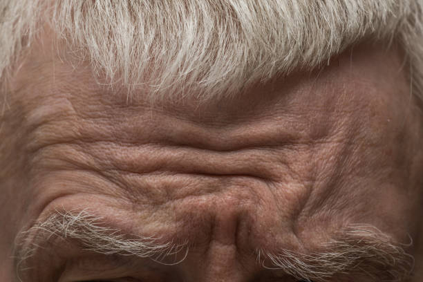 Strunkly Forehead Wrinkle Forhead Stock Photos, Pictures & Royalty-Free Images - iStock