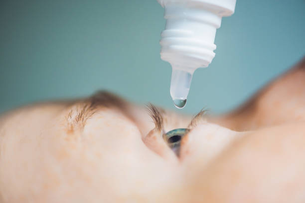 istock Closeup of eyedropper putting liquid into open eye 861619610