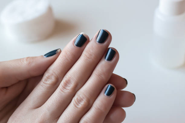 istock Shabby dark blue manicure. Threadbare nail polish. 861887980