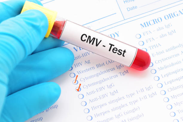 test na wirus cytomegalii (cmv) - cmv zdjęcia i obrazy z banku zdjęć