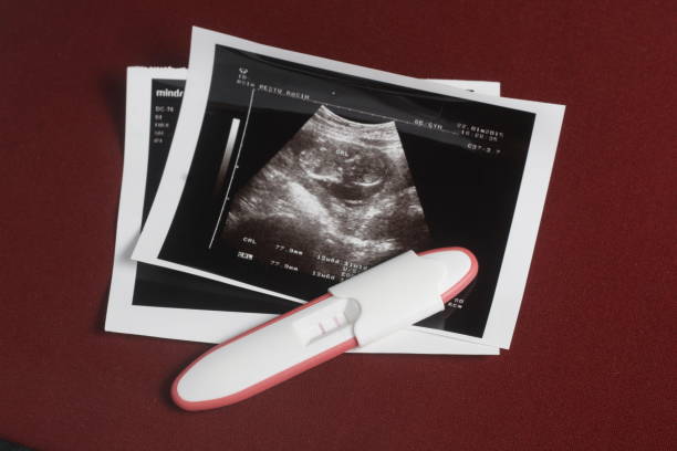 istock Close Up, Pregnancy Test Pack, Positive Result At Dark Red Background 862073728