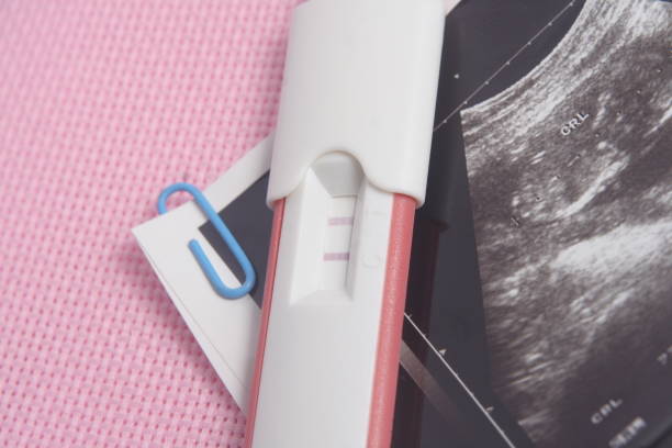 istock Pregnancy Test Pack and Ultra Sonography Picture At Pink Background 862073872