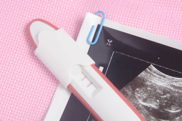 istock Pregnancy Test Pack and USG Photo Rontgen At Pink Background 862076254