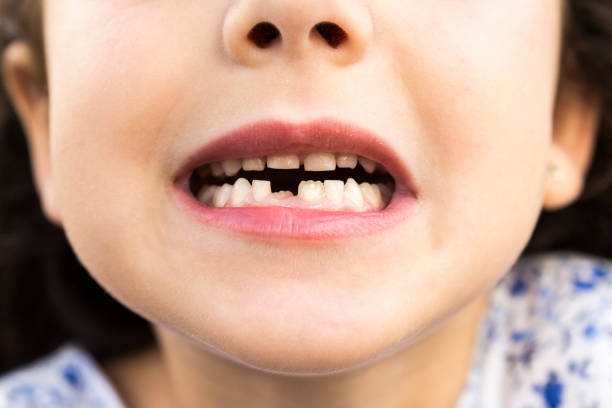 little girl showing her teeth - toothless grin imagens e fotografias de stock