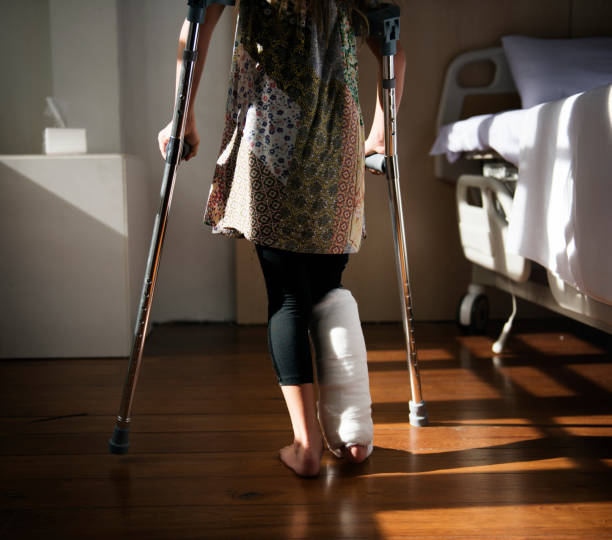istock Young Caucasian girl with broken leg in plaster cast 862557350