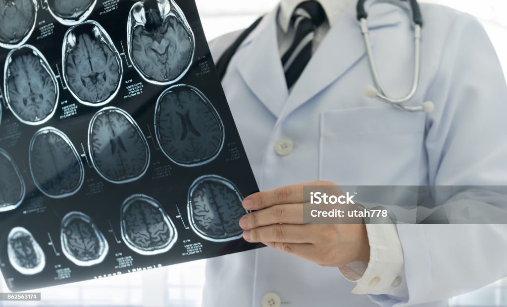 doctor brain mri Doctor check up x-ray film of the brain by mri or ct scan brain at patient room hospital. medical concept. Stroke - Illness Stock Photo