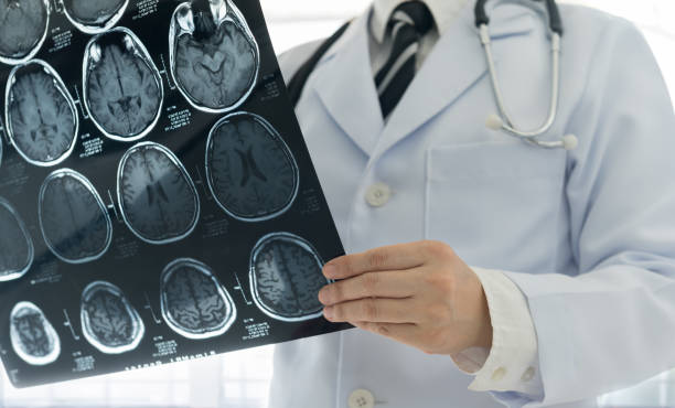 doctor brain mri Doctor check up x-ray film of the brain by mri or ct scan brain at patient room hospital. medical concept. stroke illness photos stock pictures, royalty-free photos & images