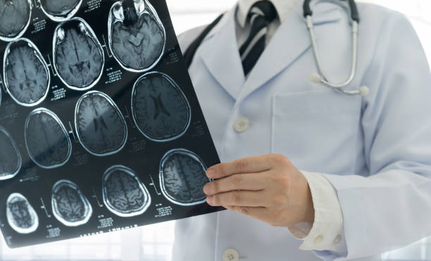 doctor brain mri Doctor check up x-ray film of the brain by mri or ct scan brain at patient room hospital. medical concept. stroke stock pictures, royalty-free photos & images