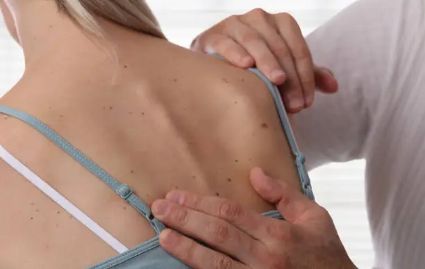 Photo of Doctor dermatologist examines birthmarks of female patient. Checking benign moles.