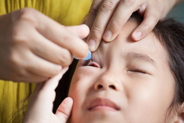 matka kapie lek na oczy w oczach dziewczynki dziecka - conjunctivitis sore eyes child human eye zdjęcia i obrazy z banku zdjęć