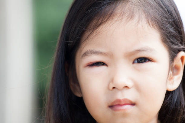 zbliżenie azjatyckiego dziecka oko puchnąć od wirusa bakterii - conjunctivitis sore eyes child human eye zdjęcia i obrazy z banku zdjęć