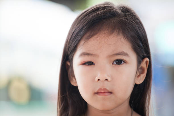 박테리아 바이러스에서 아시아 아이 여자 눈의 팽창 - conjunctivitis sore eyes child human eye 뉴스 사진 이미지