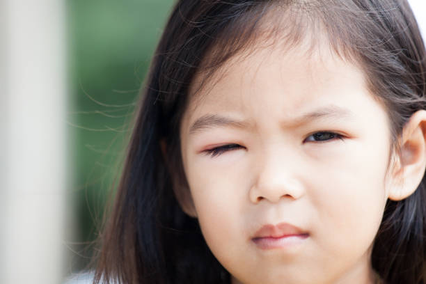 박테리아 바이러스에서 아시아 아이 여자 눈의 팽창 - conjunctivitis sore eyes child human eye 뉴스 사진 이미지