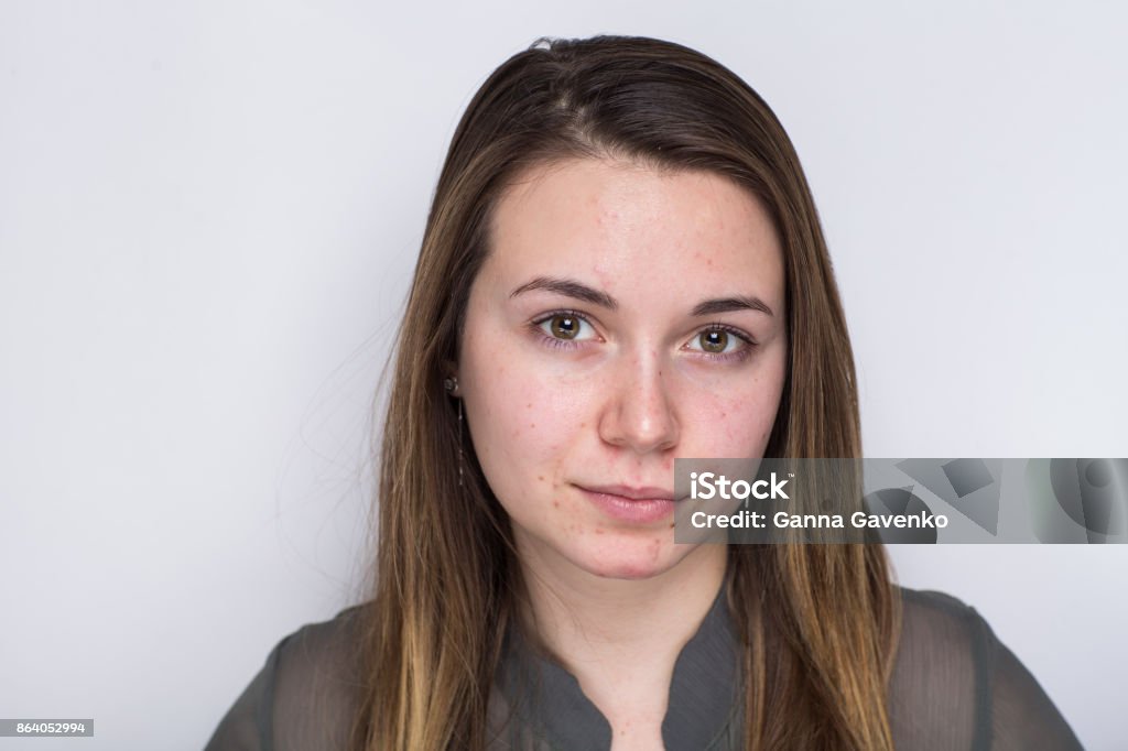beauty beautiful art Portrait of a serious young woman with no make up, messy hair, standing on a white grey background in studio. Natural image without retouching. Horizontal photo. tired eyes and problem skin pink spots Acne Stock Photo
