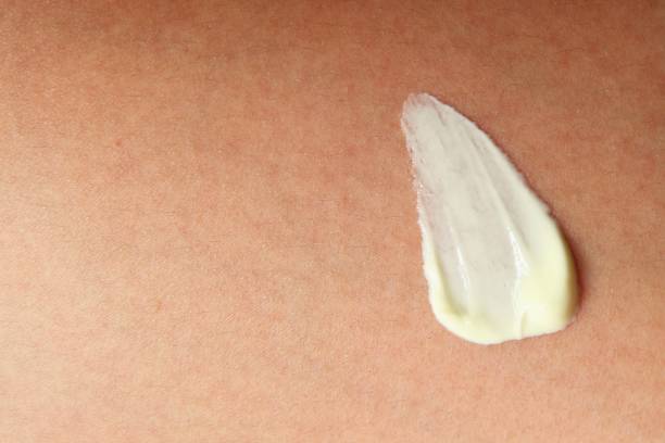istock Human Skin with cream 864133408