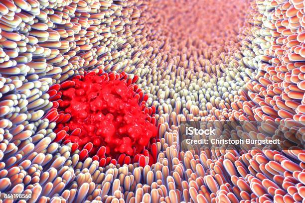 3d Illustration Of Microscopic Closeup Of Intestine Villus And S Stock Photo - Download Image Now