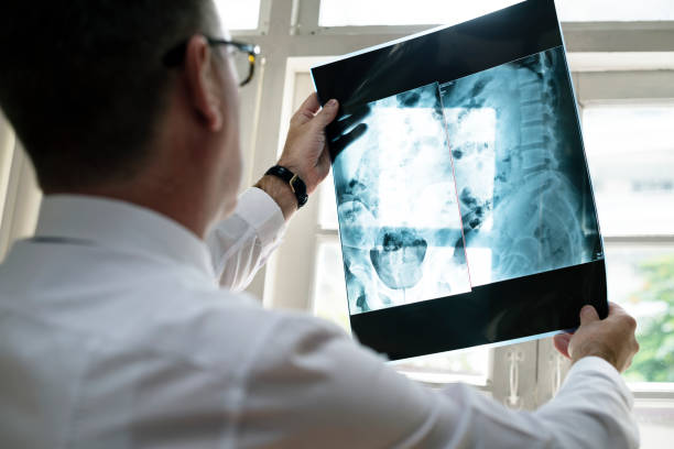 istock Doctor is checking patient x-ray film 864474212