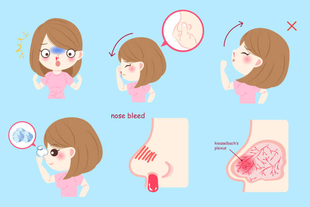 woman with nose bleed woman with nose bleed on the blue background bloody nose stock illustrations