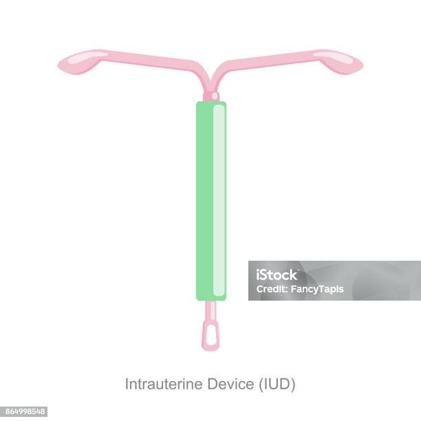 Intrauterine Device Iud Stock Illustration - Download Image Now - Diagram, IUD, Spiral