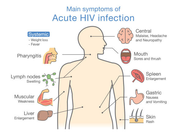 ilustrações, clipart, desenhos animados e ícones de principais sintomas de infecção aguda pelo hiv. - aids