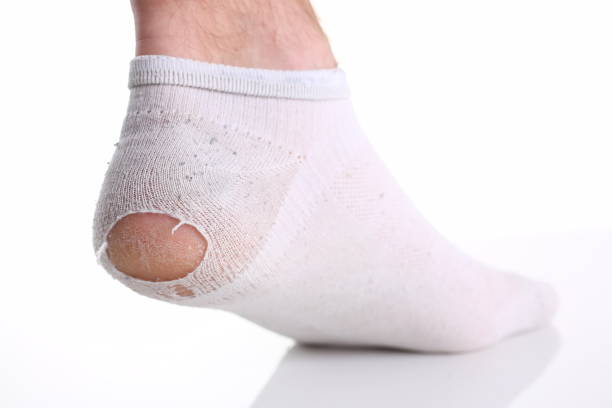 istock Ripped white sock on male leg isolated 865733588