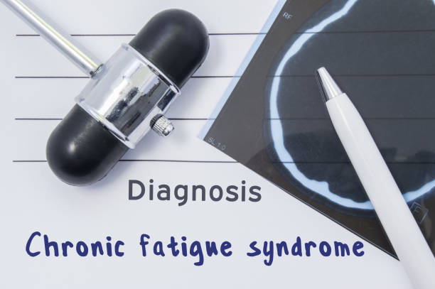 Diagnosing Chronic Fatigue Syndrome
