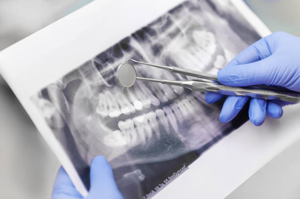gros plan de mains de dentiste et équipement dentaire - dentist mirror orthodontist carver photos et images de collection