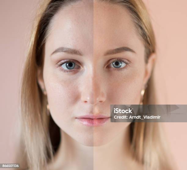 青い目をした美人 - 前と後のストックフォトや画像を多数ご用意 - 前と後, 皮膚, フィルタ化